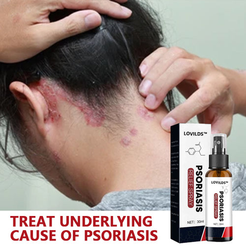Last day 80% off 🔥LOVILDS™PsoriaHeal psoriasis Treatment Spray pro
