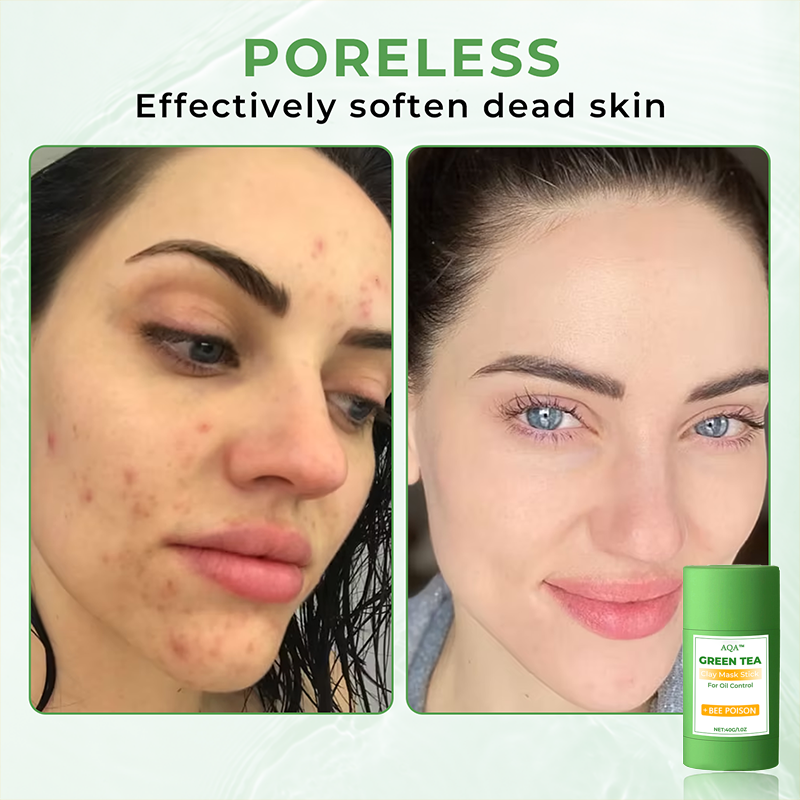 🔥Limited time discount 50% 🔥,new products new packaging🔥 AQA" Clay Mask Stick🍃 :BEE POISON + Green Tea Power