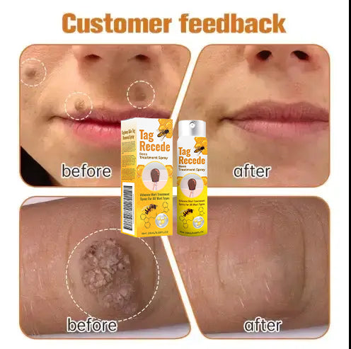 ✨𝐋𝐚𝐬𝐭 𝐃𝐚𝐲 𝐃𝐢𝐬𝐜𝐨𝐮𝐧𝐭: 87% 𝐎𝐅𝐅 🐝AQA™ TagRecede Bees  Treatment Spray