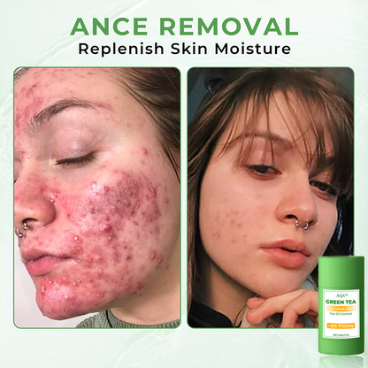 🔥Limited time discount 50% 🔥,new products new packaging🔥 AQA" Clay Mask Stick🍃 :BEE POISON + Green Tea Power