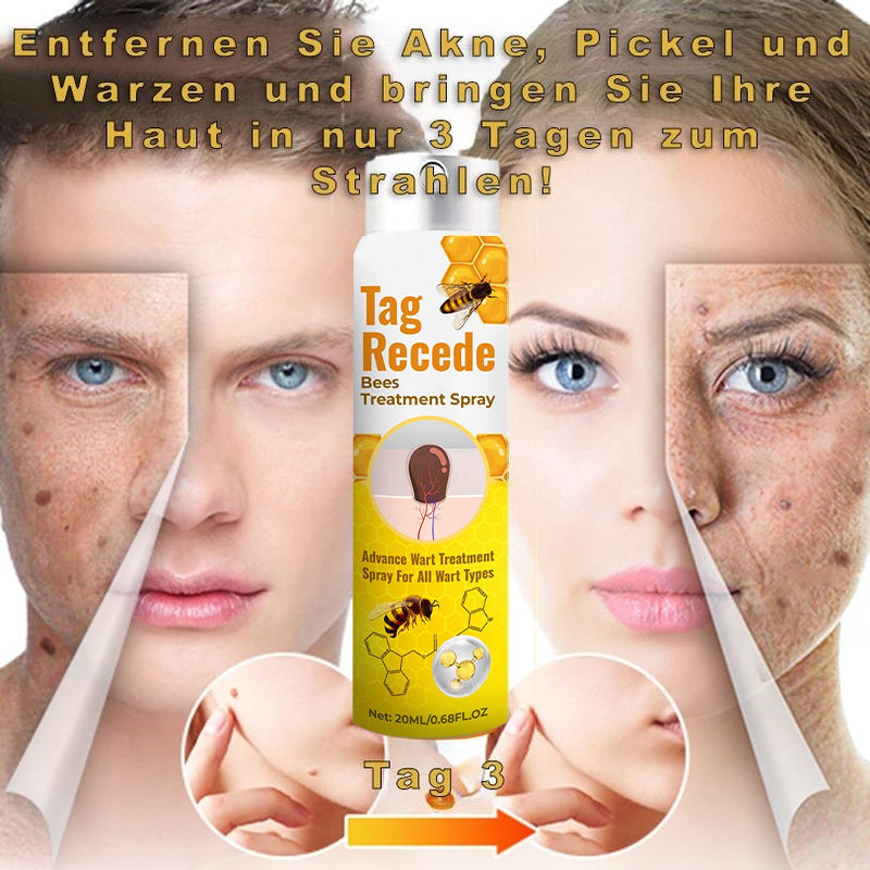 ✨𝐋𝐚𝐬𝐭 𝐃𝐚𝐲 𝐃𝐢𝐬𝐜𝐨𝐮𝐧𝐭: 87% 𝐎𝐅𝐅 🐝AQA™ TagRecede Bees  Treatment Spray