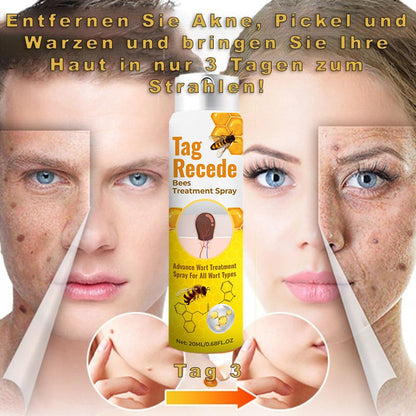 ✨𝐋𝐚𝐬𝐭 𝐃𝐚𝐲 𝐃𝐢𝐬𝐜𝐨𝐮𝐧𝐭: 87% 𝐎𝐅𝐅 🐝AQA™ TagRecede Bees  Treatment Spray