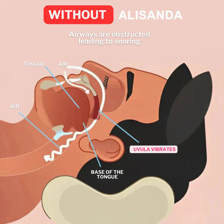 ALISANDA PerfectSleep Solution – Snore-Reducing & Teeth-Grinding Guard 41 download 8f050499 74b0 44e8 ab6d e69340794a88